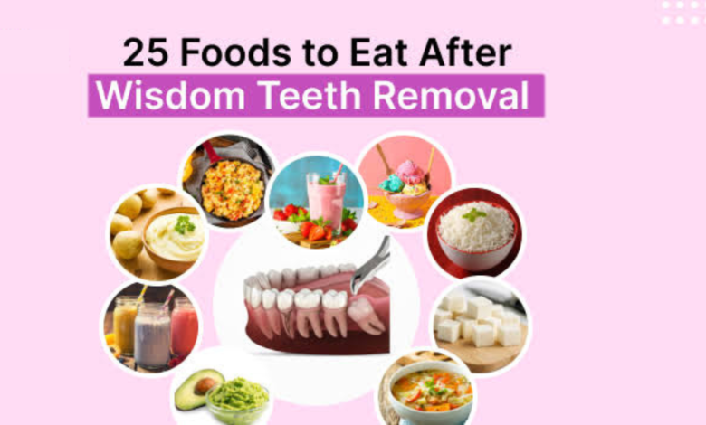 what can i eat after wisdom teeth removal