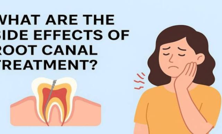 root canal treatment side effects